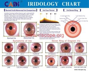 Iridology Charts A Comprehensive Exploration Maikong Iridology Kamera